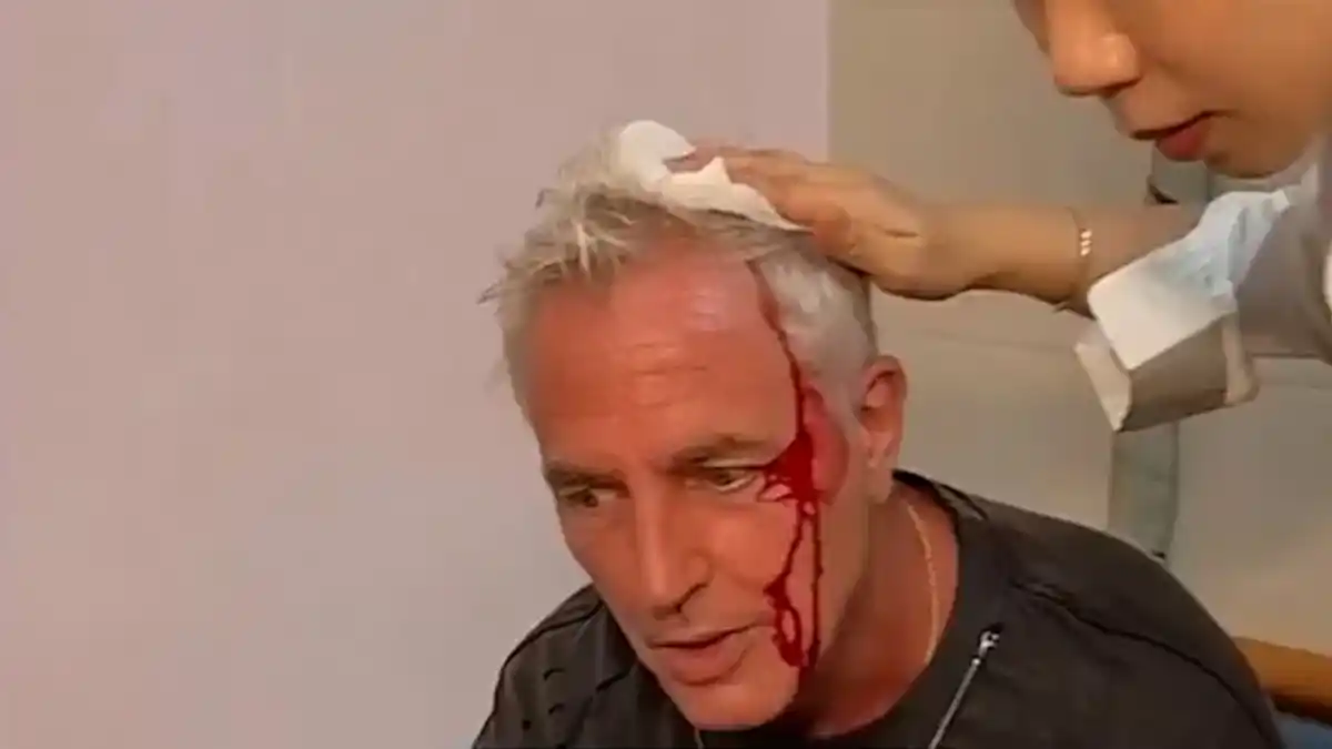 Marley se accidentó en Tailandia