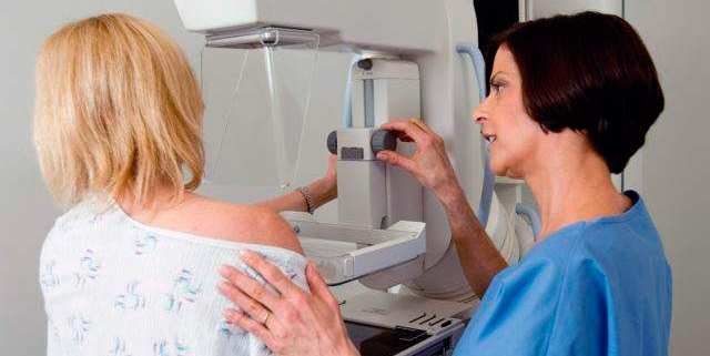 Realizarán mamografías gratis sin turnos