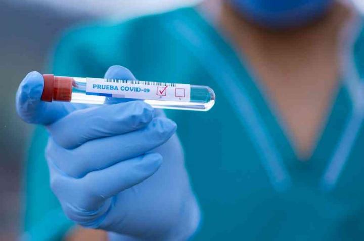 Ceres sumó 2 casos positivos de coronavirus