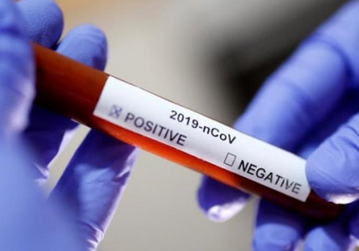 Coronavirus en Santa Fe: 27 muertos y 2078 contagios