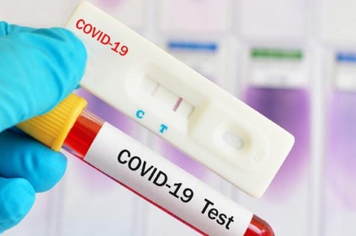 Bajan los casos de coronavirus en Santa Fe