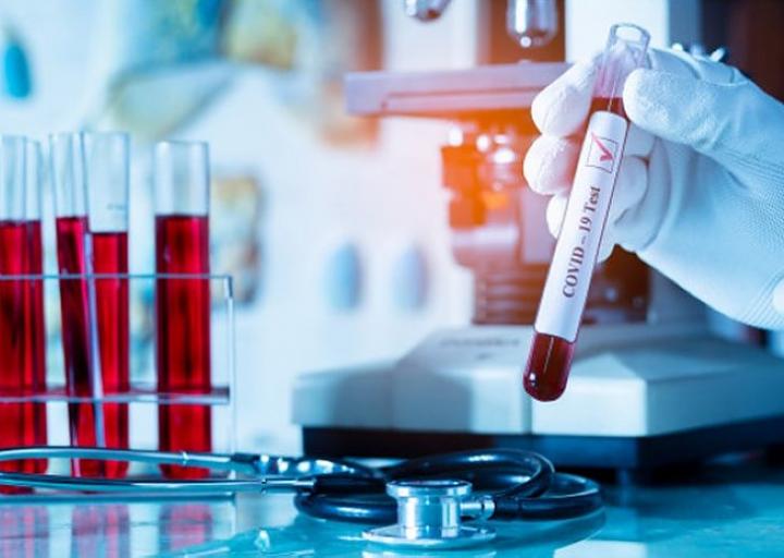 Santa Fe registra el menor promedio de contagios diarios 