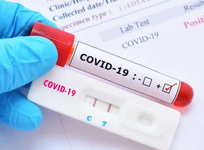 Siguen bajando los contagios de coronavirus