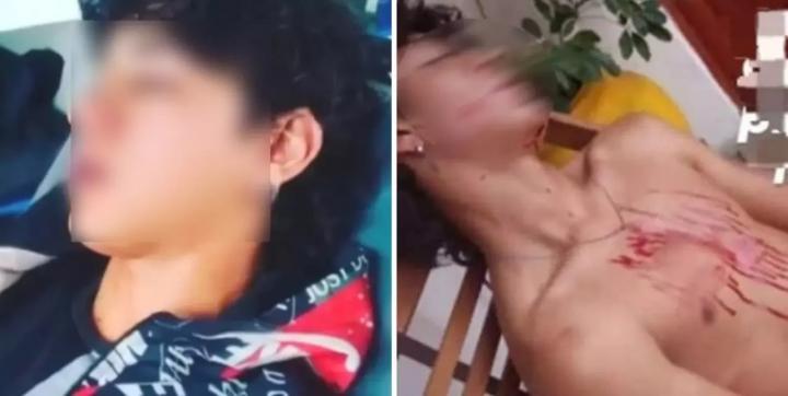 Quince adolescentes golpearon salvajemente a un joven 