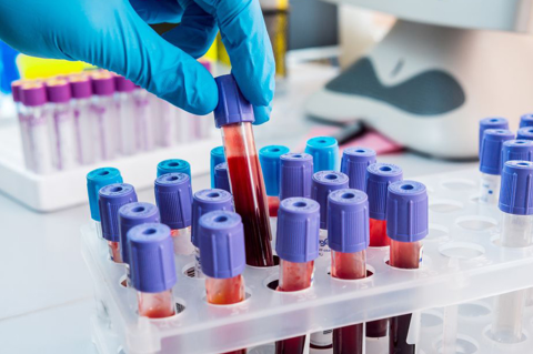 Bioquímicos comenzaron a cobrar la diferencia de arancel