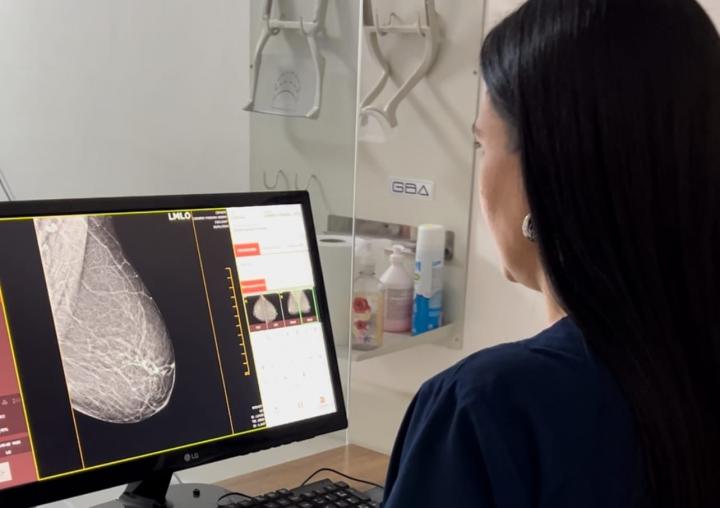 Las mujeres entre 50 y 69 años deben hacerse una mamografía cada año.
