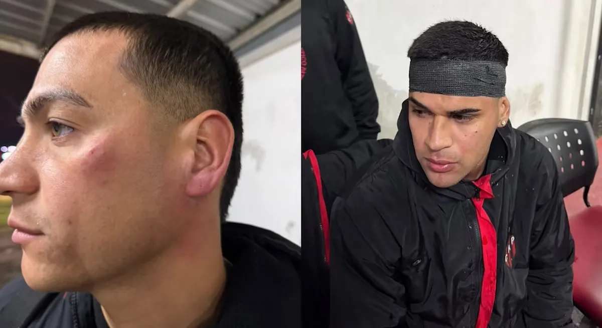 Violencia en Patronato: la barra brava agredió a los jugadores 